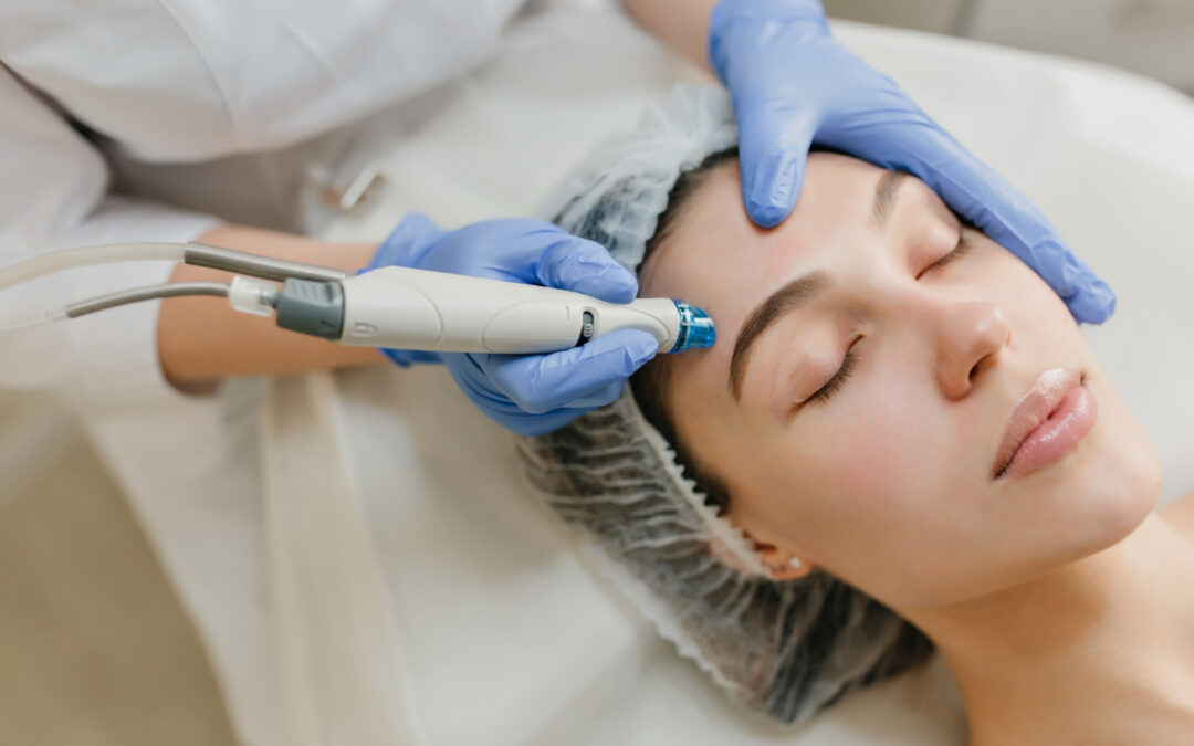 Microneedling: An Effective Tool for Skin Rejuvenation and Repair