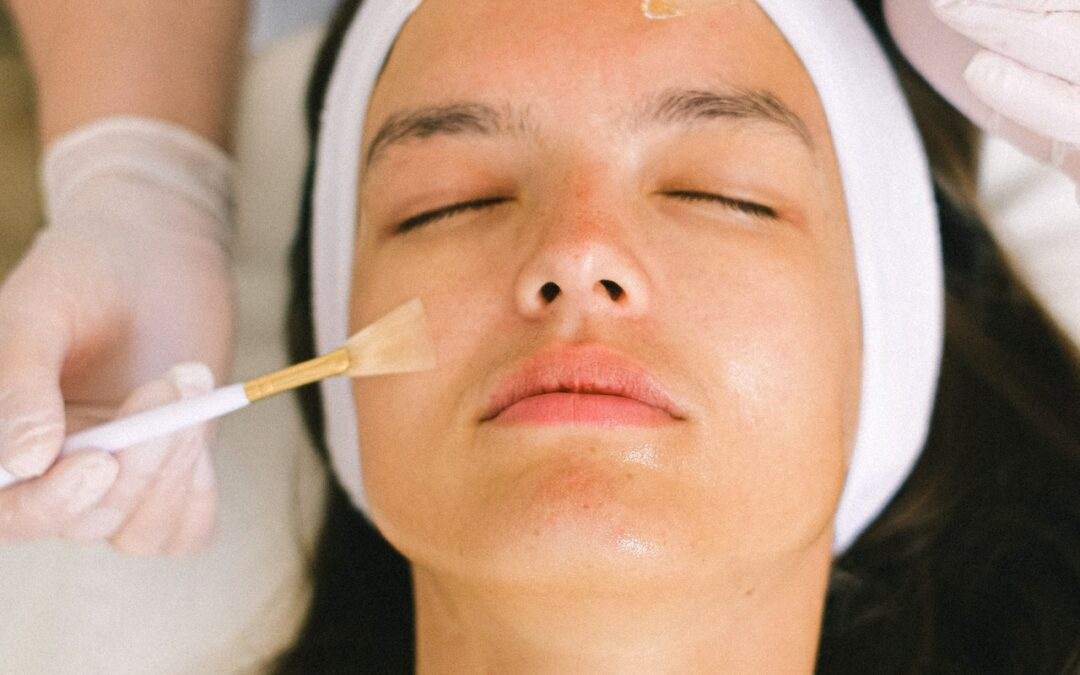 Exploring Chemical Peels: Types, Benefits, and Your Path to Radiant Skin