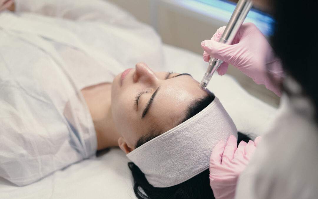Microneedling: Revitalizing Your Skin with Collagen Induction Therapy