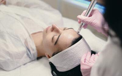 Microneedling: Revitalizing Your Skin with Collagen Induction Therapy