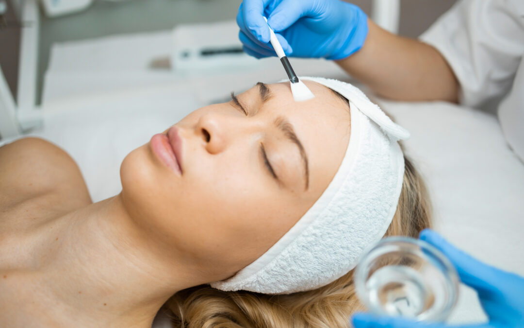 Chemical peels are a popular skincare