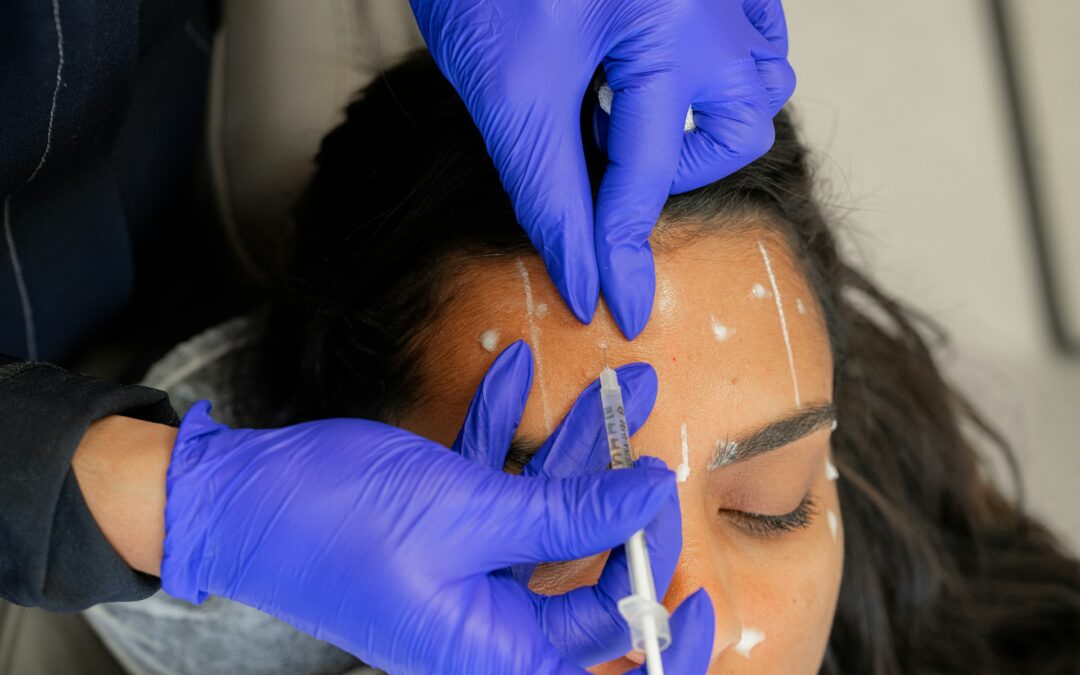 Botox vs Fillers: Which is Right for You?